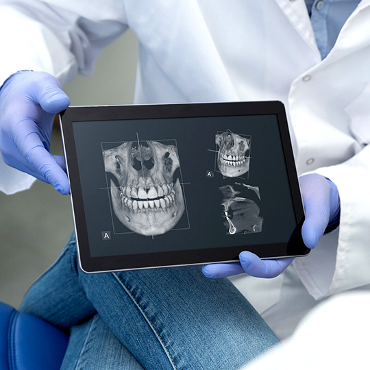 3D снимок челюсти пациента