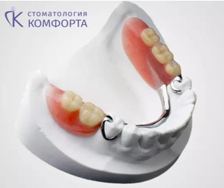 Фото съёмного протеза