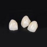 фото зубных коронок из диоксида циркония